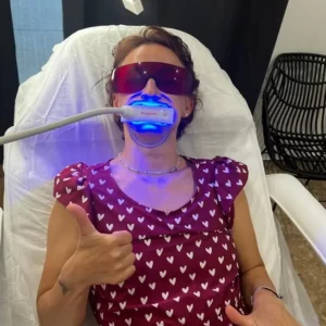 Qué no comer después de un blanqueamiento dental